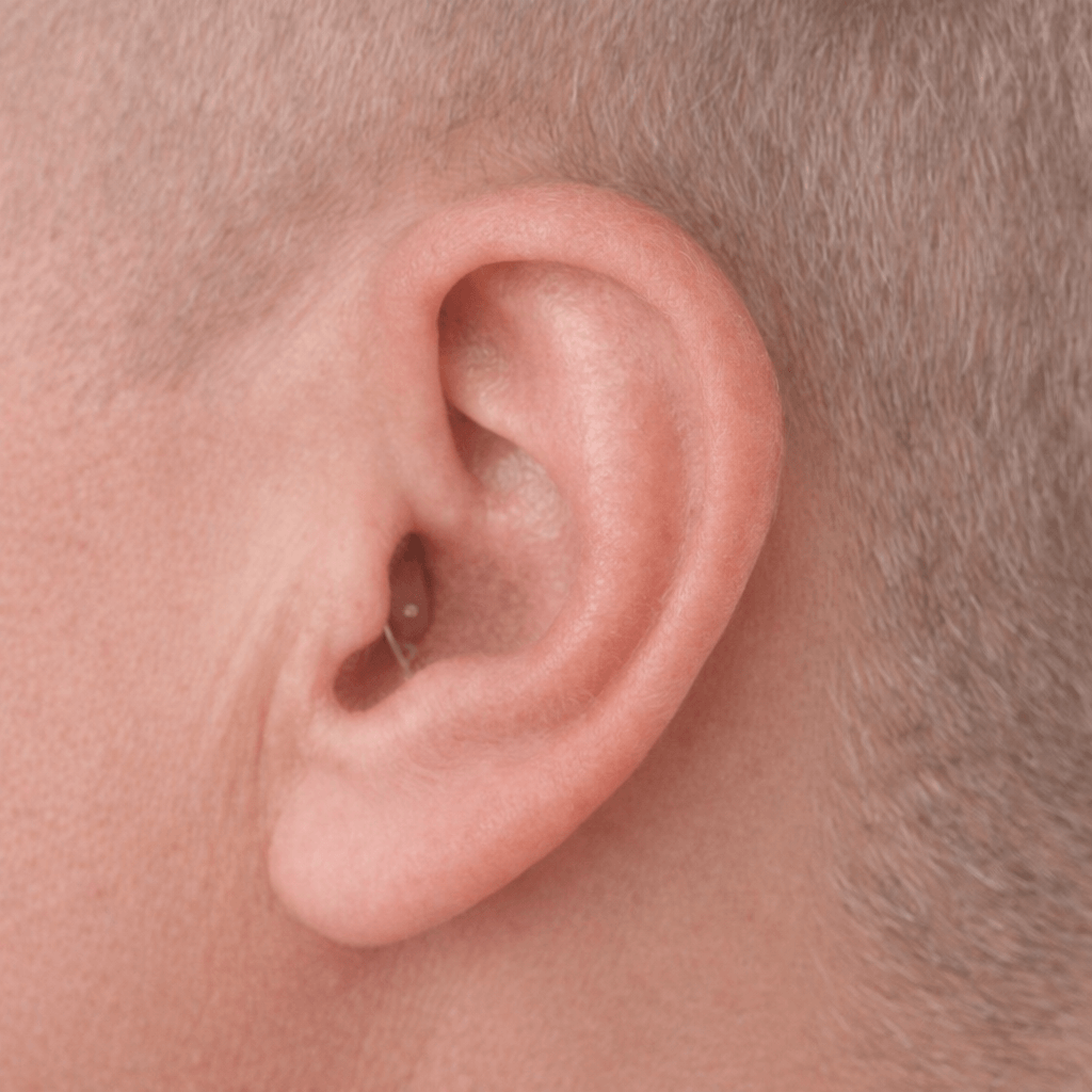 Invisible in Canal hearing aid